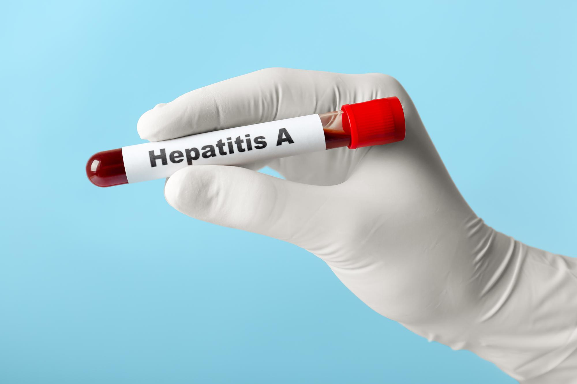 Hepatites virais: o que você precisa saber sobre essa doença silenciosa ...