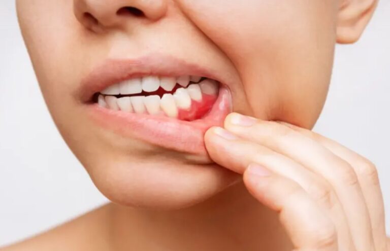 Saúde bucal e doenças cardiovasculares: um elo que vai muito além do sorriso