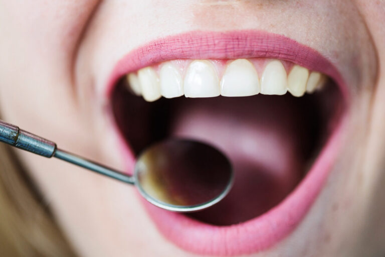 Câncer de boca: feridas que não cicatrizam exigem atenção do dentista