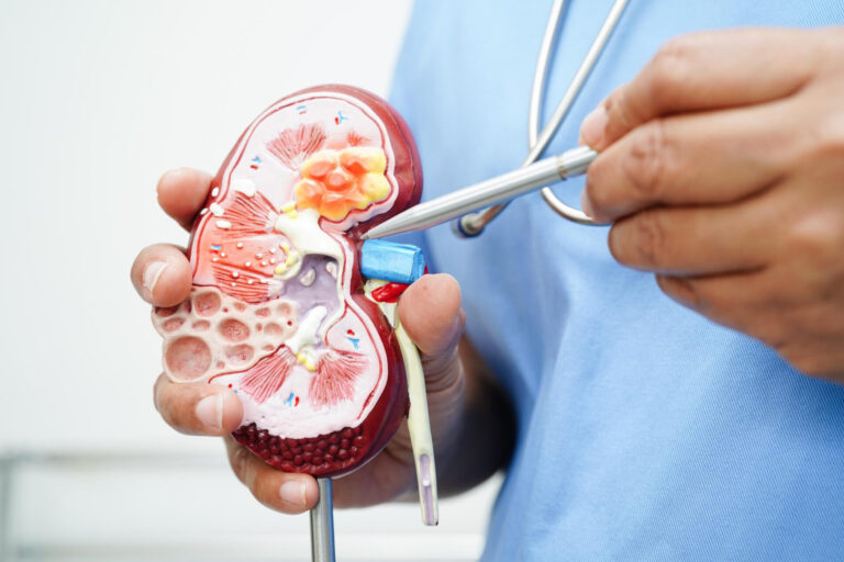 Transplante de rim muda vidas e avança no Brasil: saiba como funciona